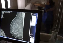 Ministério da Saúde passa a recomendar mamografia a partir dos 40 anos